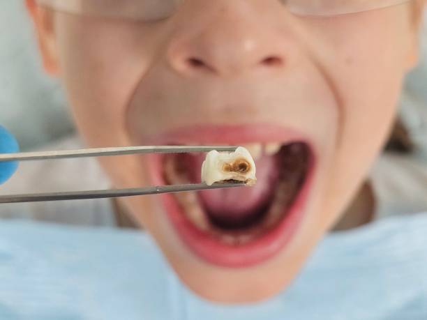 Best Dentist for Severe Toothache  in Lyons, IL