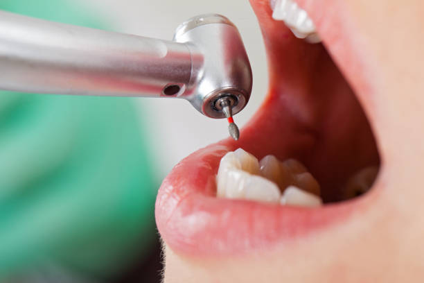 Best Broken Tooth Emergency  in Lyons, IL